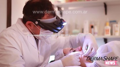 Limpieza facial con extracciones de puntos negros - Imagen 5