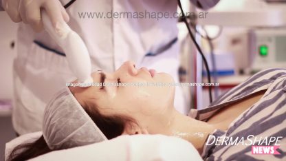 Limpieza facial con extracciones de puntos negros - Imagen 6