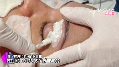 Peeling para Labios Escamosos y Párpados Opacos - Imagen 9