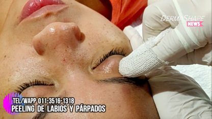 Peeling para Labios Escamosos y Párpados Opacos - Imagen 6
