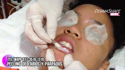 Peeling para Labios Escamosos y Párpados Opacos - Imagen 5