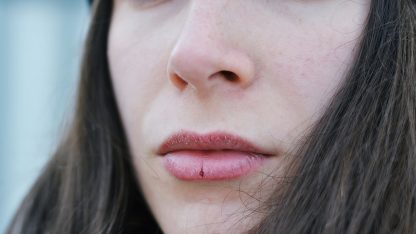 Peeling para Labios Escamosos y Párpados Opacos - Imagen 2