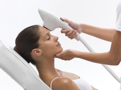Luz Pulsada IPL para manchas faciales y rosacea