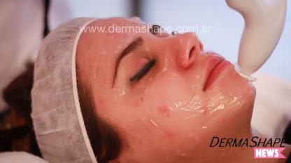 Facials in Buenos Aires - Imagen 4