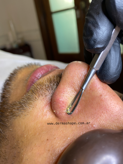 Facials in Buenos Aires - Imagen 3